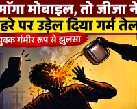 माँगा मोबाइल, तो जीजा ने चेहरे पर उड़ेल दिया गर्म तेल, युवक गंभीर रूप से झुलसा