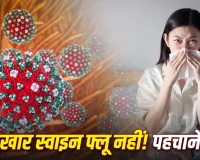 स्वाइन फ्लू है या सिर्फ वायरल फीवर? लक्षणों से कैसे करें पहचान, जानें कब जरूरी है टेस्ट