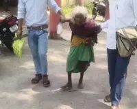 90 साल की बुजुर्ग पर जुल्म का आरोप! गर्म पानी डालने से झुलसी पीठ, आंख के ऊपर चोट; जख्म लेकर इंसाफ की गुहार लगाने पहुंची जनपद