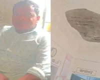 Surajpur School Accident: स्कूल की छत से बरसा प्लास्टर, शिक्षक घायल; सरकारी स्कूलों की सुरक्षा पर सवाल