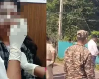 Balod Acid Attack: स्कार्फ ने बचाया युवती का चेहरा, दाहिनी आंख पर तेजाब का गंभीर असर; डॉक्टरों की निगरानी में इलाज
