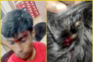 रायपुर: टिकरापारा में युवक पर चाकू से जानलेवा हमला, इलाके में दहशत का माहौल, जांच में जुटी पुलिस 