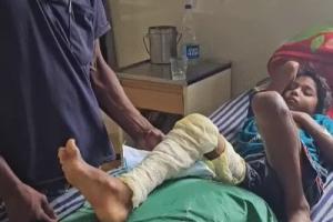 छत्तीसगढ़: दूसरी कक्षा की छात्रा को हेडमास्टर ने डंडे से पीटा, पैर में फ्रैक्चर, 3 दिन से अस्पताल में भर्ती, शिक्षक पर अब तक नहीं हुई कार्रवाई 