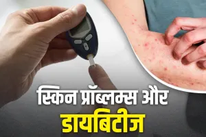 स्किन पर दिखने वाले ये लक्षण न करें नजरअंदाज, हो सकते हैं डायबिटीज के संकेत