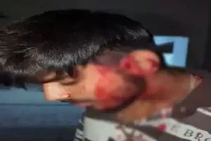 RAIPUR की पॉश सोसाइटी में चाकूबाजी! गाना बजाने को लेकर बवाल, प्रॉपर्टी डीलर के बेटे को चाकू मारकर फरार हुए आरोपी