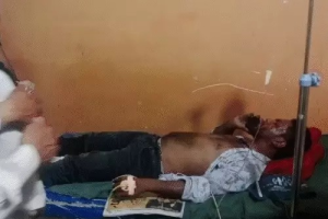 Bilaspur Shocker: AC कंप्रेसर ब्लास्ट से मची अफरा-तफरी, मरम्मत कर रहे दो भाई गंभीर रूप से घायल
