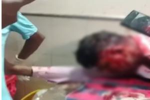 मामूली बहस बनी खूनी झड़प: रायपुर एयरपोर्ट के बाहर ऑटो चालक ने बोतल फोड़कर किया हमला, आरोपी गिरफ्तार, मचा हड़कंप