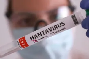 Hanta Virus Alert: इन लोगों को ज्यादा रहता है हंता वायरस का खतरा, एक्सपर्ट ने बताए बचाव के जरूरी तरीके