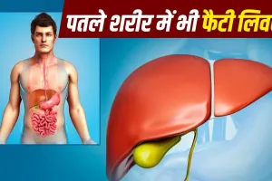 सिर्फ मोटे ही नहीं, दुबले लोग भी हो सकते हैं फैटी लिवर के शिकार! जानें कारण, लक्षण और बचाव