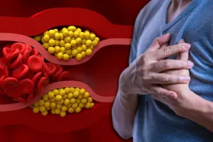 High Cholesterol क्यों बढ़ता है? रोज की ये गलत आदतें बना सकती हैं हार्ट डिजीज का कारण, जानें एक्सपर्ट की सलाह