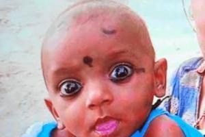 रिश्तों का डरावना चेहरा: चाचा ने 2 साल की भतीजी को जलते चूल्हे में फेंका, इलाज के दौरान मौत