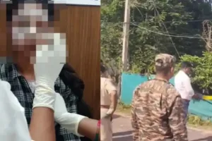 Balod Acid Attack: स्कार्फ ने बचाया युवती का चेहरा, दाहिनी आंख पर तेजाब का गंभीर असर; डॉक्टरों की निगरानी में इलाज