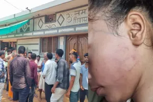 Gariaband News: गणित का जवाब नहीं दे पाई 8 साल की छात्रा तो शिक्षक ने मारे थप्पड़, बच्ची सहमी; परिजनों ने मांगी कार्रवाई